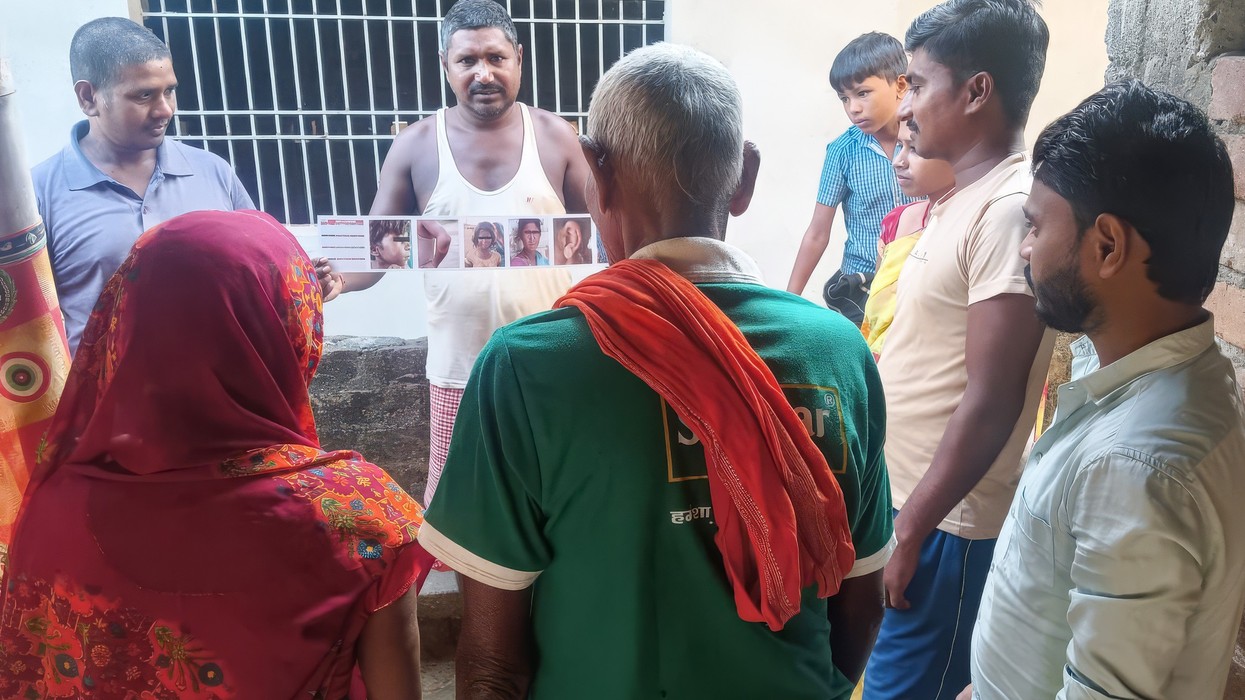 Discussion of the early signs and symptoms of leprosy