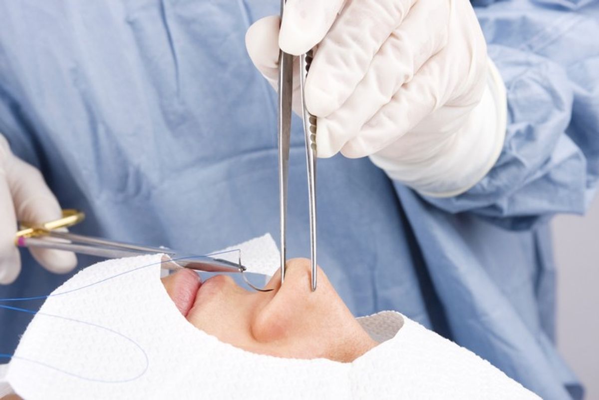 21-year-old woman tragically dies after nose job goes horribly wrong