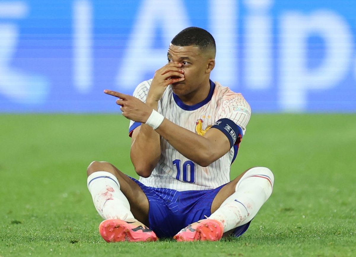 France captain Kylian Mbappe left with a bloodied nose during a match against Austria in Euro 2024.