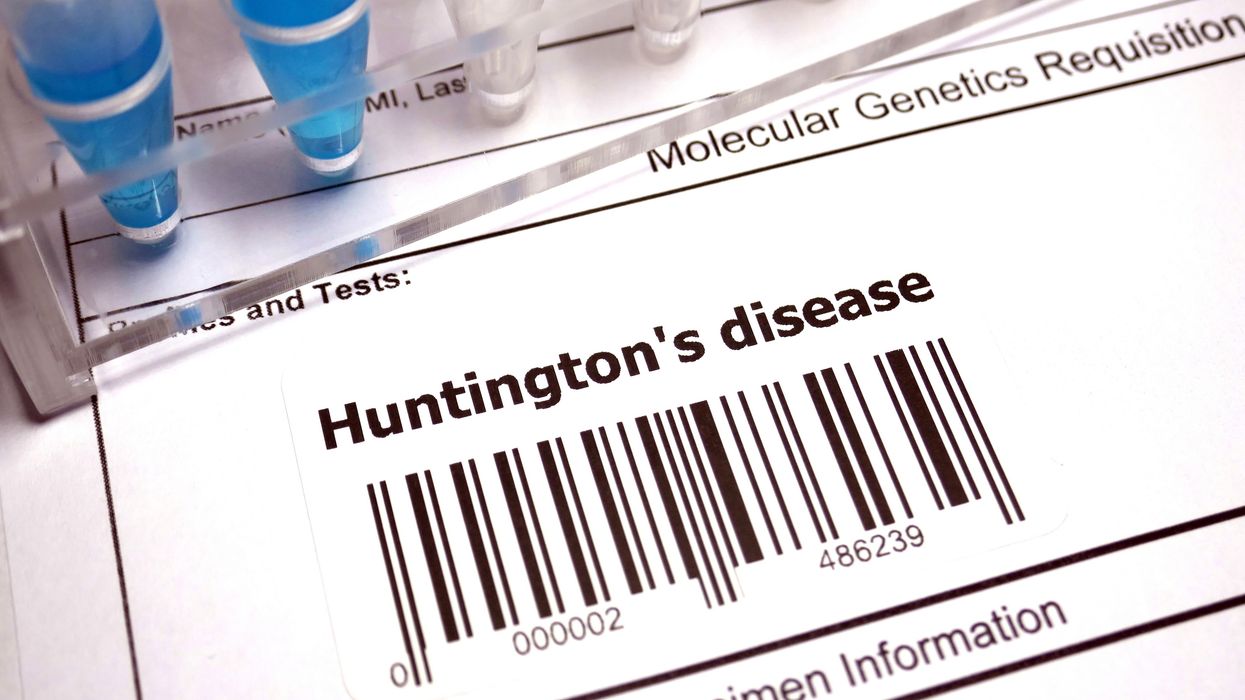 Huntington’s disease treatment 2025
