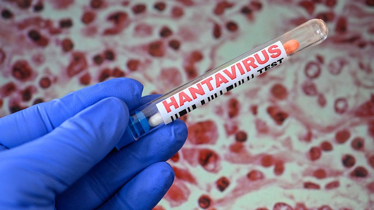 Health officials monitor dozens despite no known US Hantavirus cases