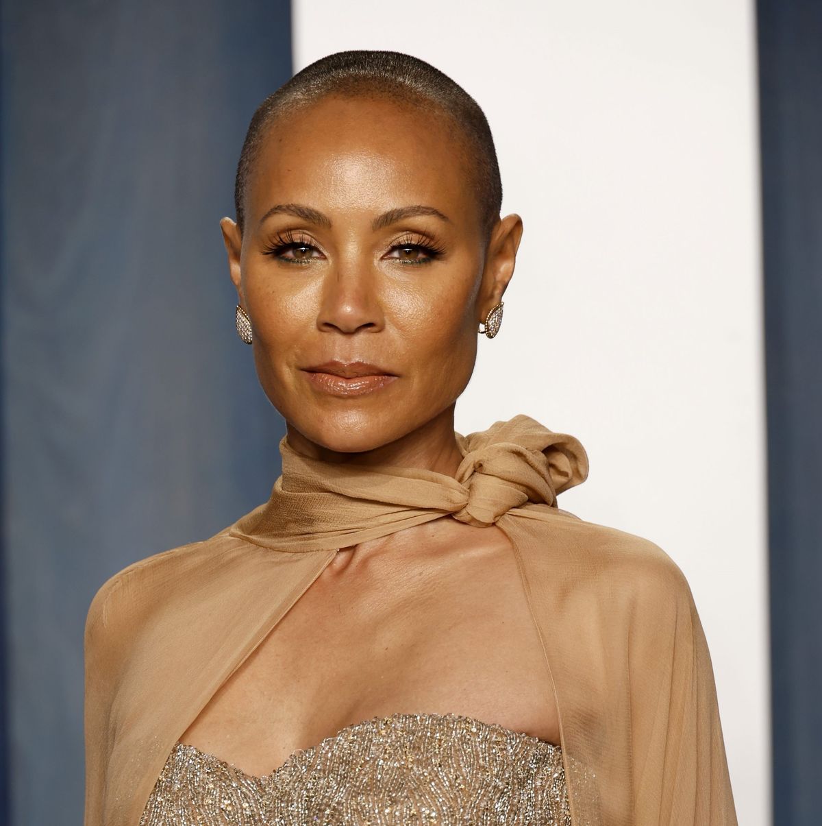 First ever drug for alopecia hair loss disorder which affects Jada Pinkett Smith and thousands of Brits to get funded by NHS