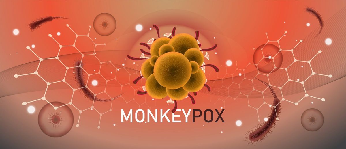 Monkeypox vs. Chickenpox: What is the difference between the two?