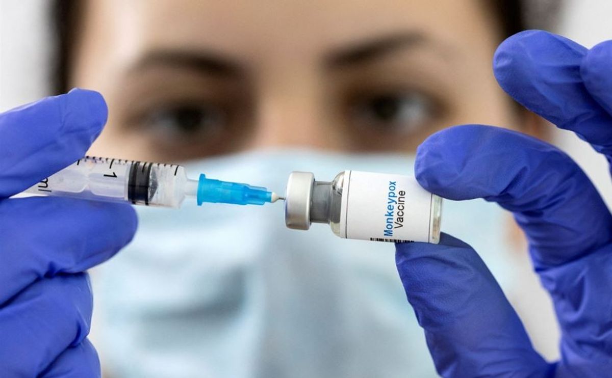 Health agency confirms community spread of monkeypox in England