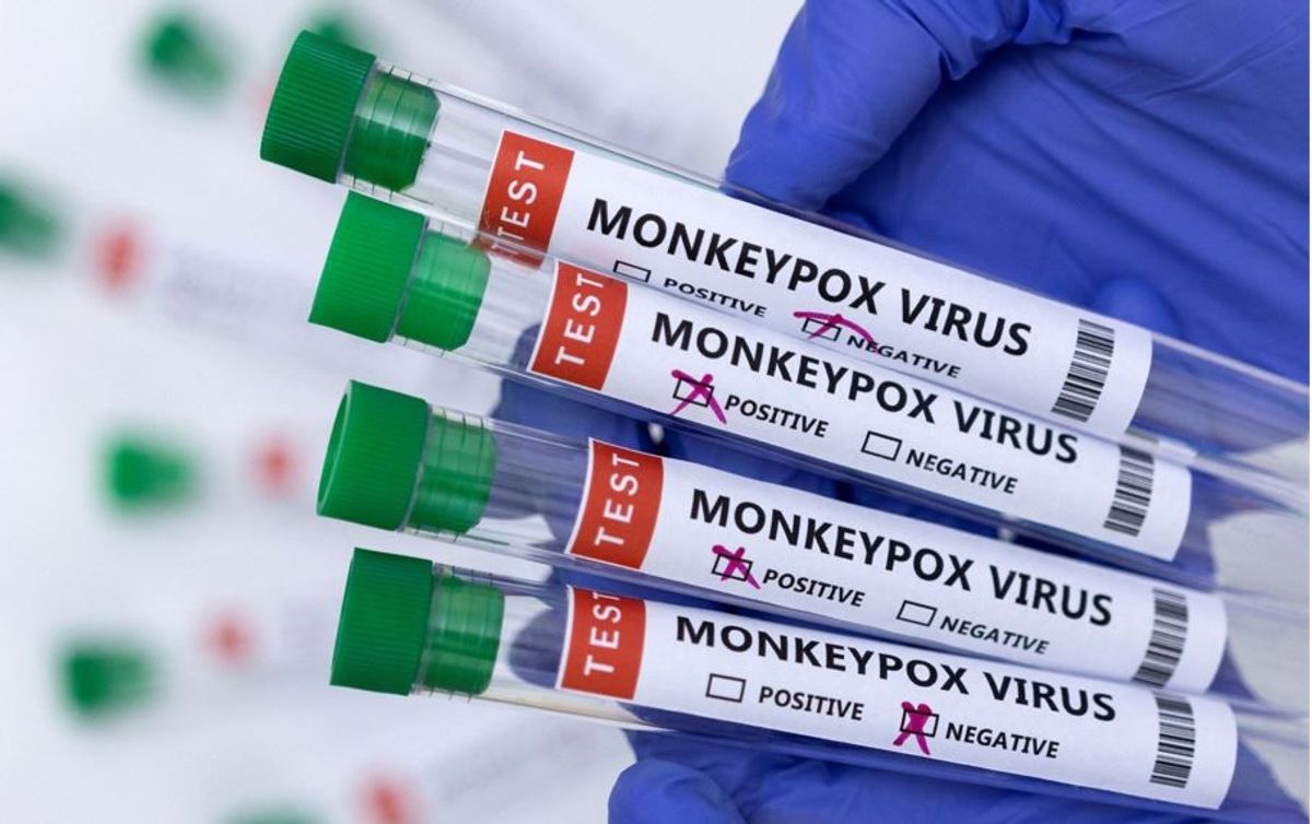 Turning crisis into opportunity: Test makers target monkeypox market as cases surge
