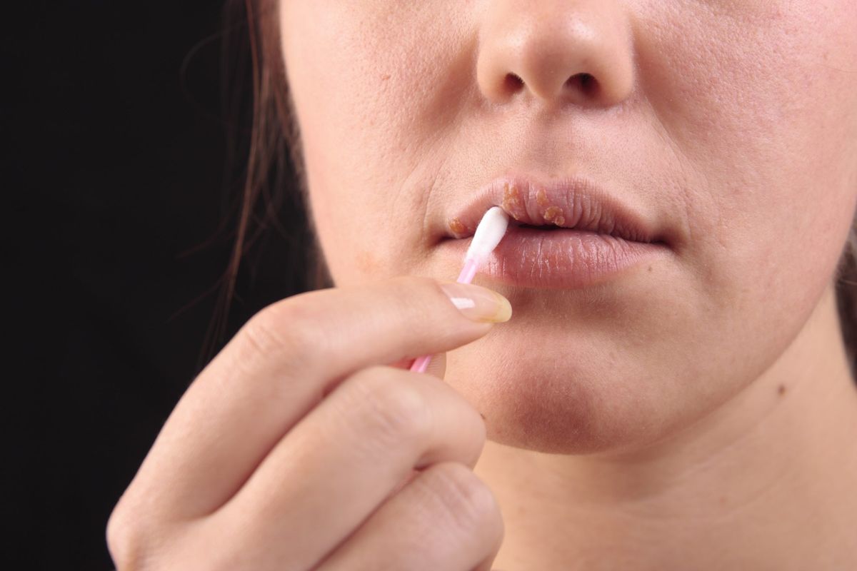 These symptoms on your face and lips may indicate the deficiency of this vitamin