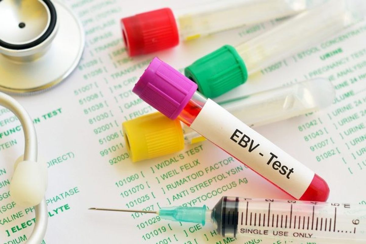 Researchers uncover trigger mechanism for onset of multiple sclerosis