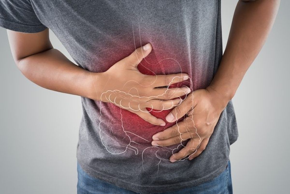 Screening programme prevents 20,000 cases of bowel cancer; expansion planned for over 50s