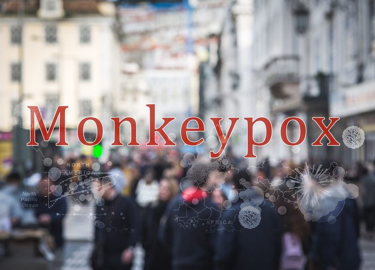 Monkeypox: People with symptoms should abstain from sex, the risk of a case infecting a pet is low, UK health advisory