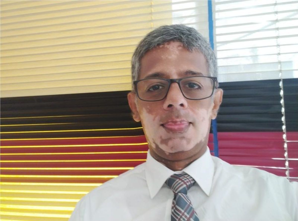 ‘I was desperate to update my profile pic’: This Sri Lankan CEO with ‘Vitiligo’ has an important message about body image