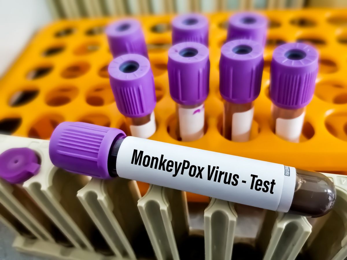 US gay, bisexual men drastically reduce sex partners due to monkeypox fear: report