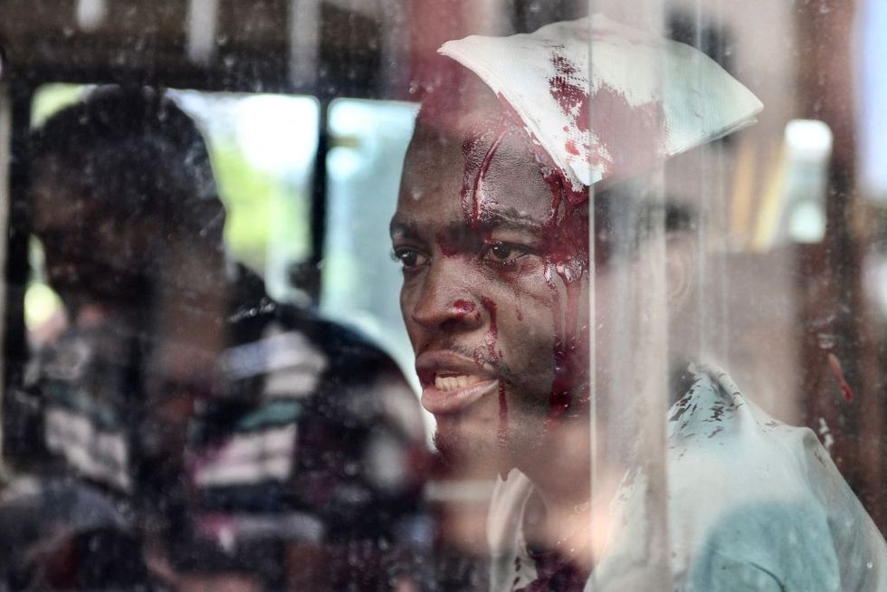 Congolese student's death: Six African nationals injured during protest