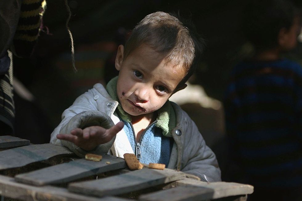 Malnourished India: Over 70% of Indians can't afford healthy food, says UN report