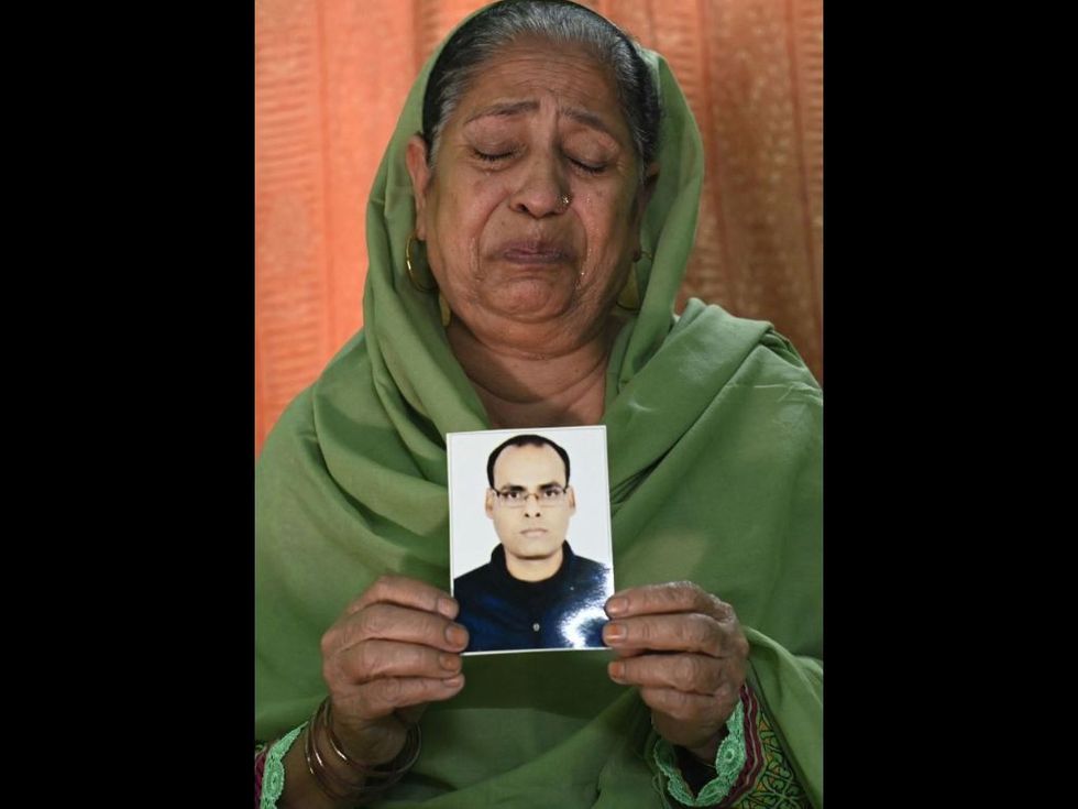 Why hair transplant, apparently an innocuous procedure, has rung alarm bells in India