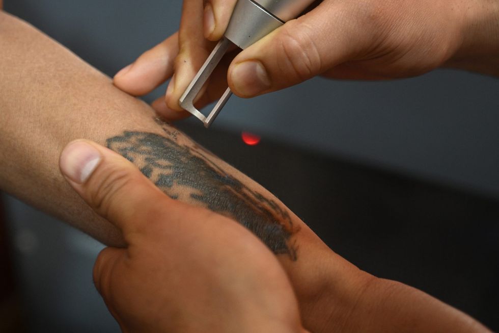 Fearing police, Kashmiris scrub 'resistance' tattoos after Pahalgam attack