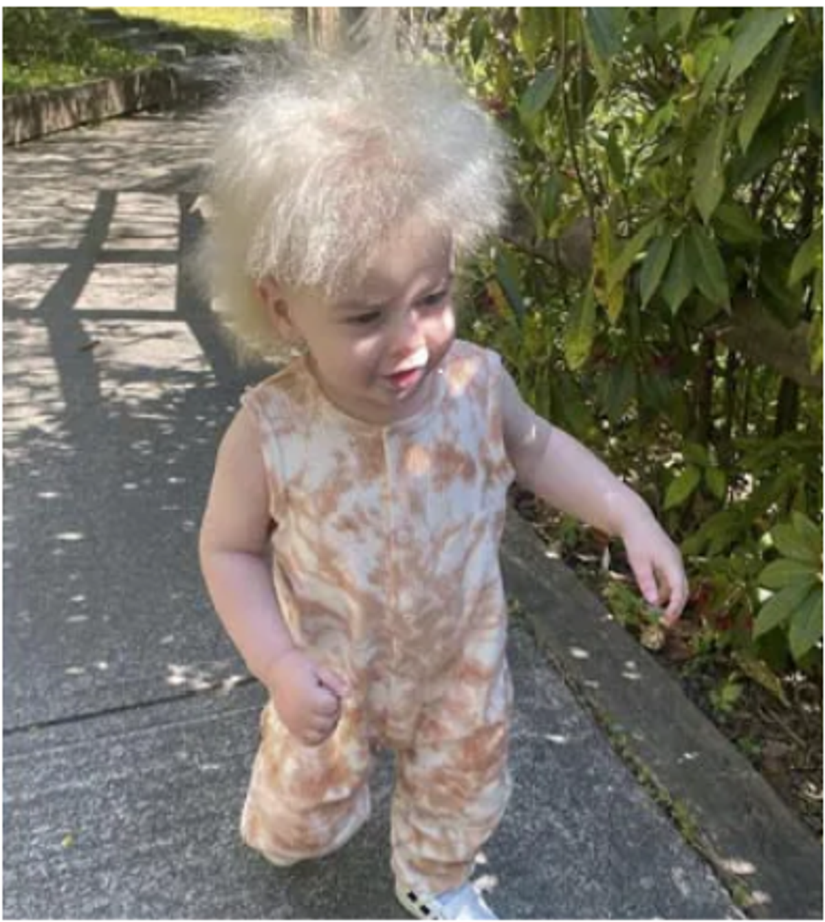 This toddler has ‘Uncombable Hair Syndrome’ which leads to dry and frizzy hair like Einstein, deets inside