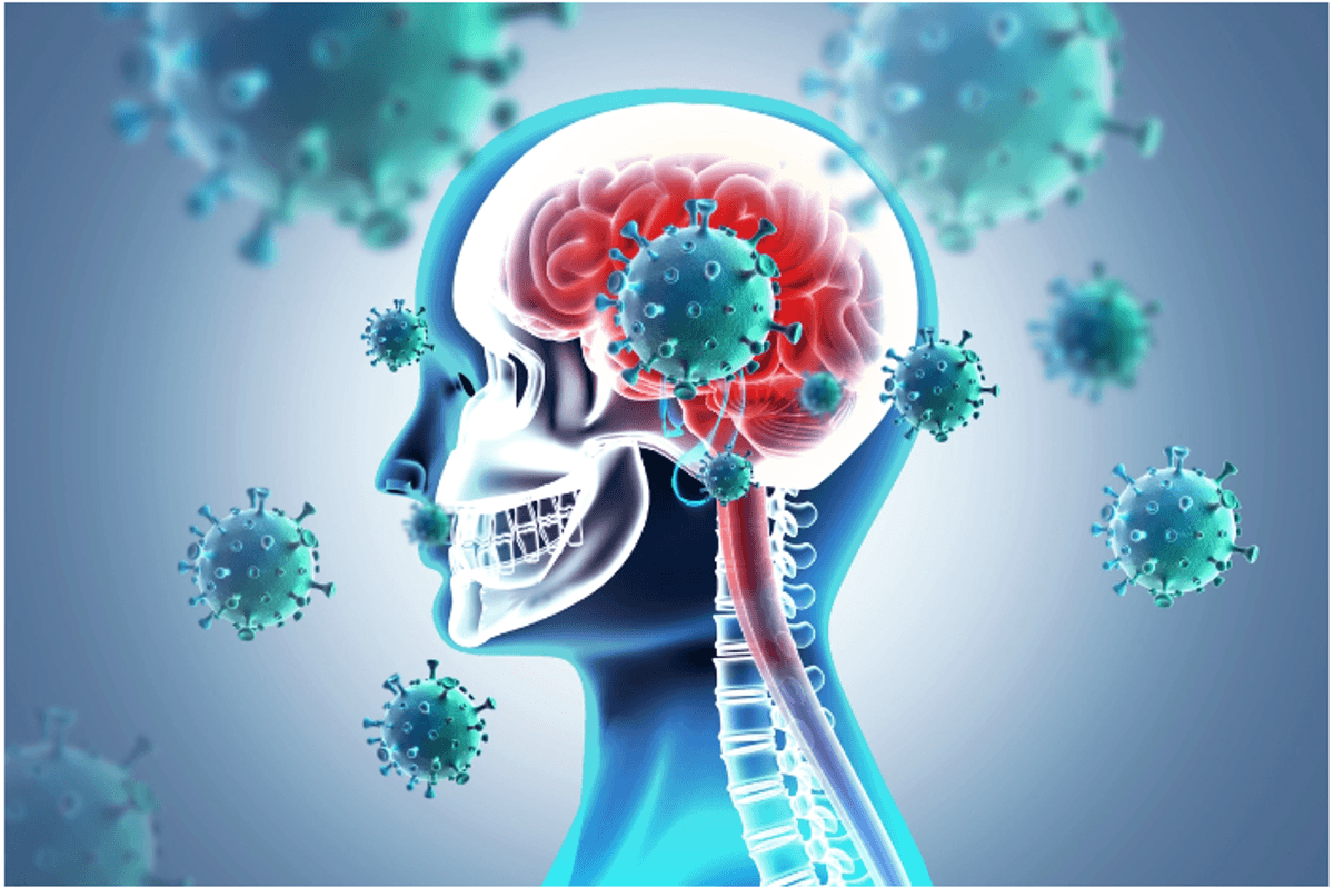 Covid pandemic altered teens’ brains, study finds