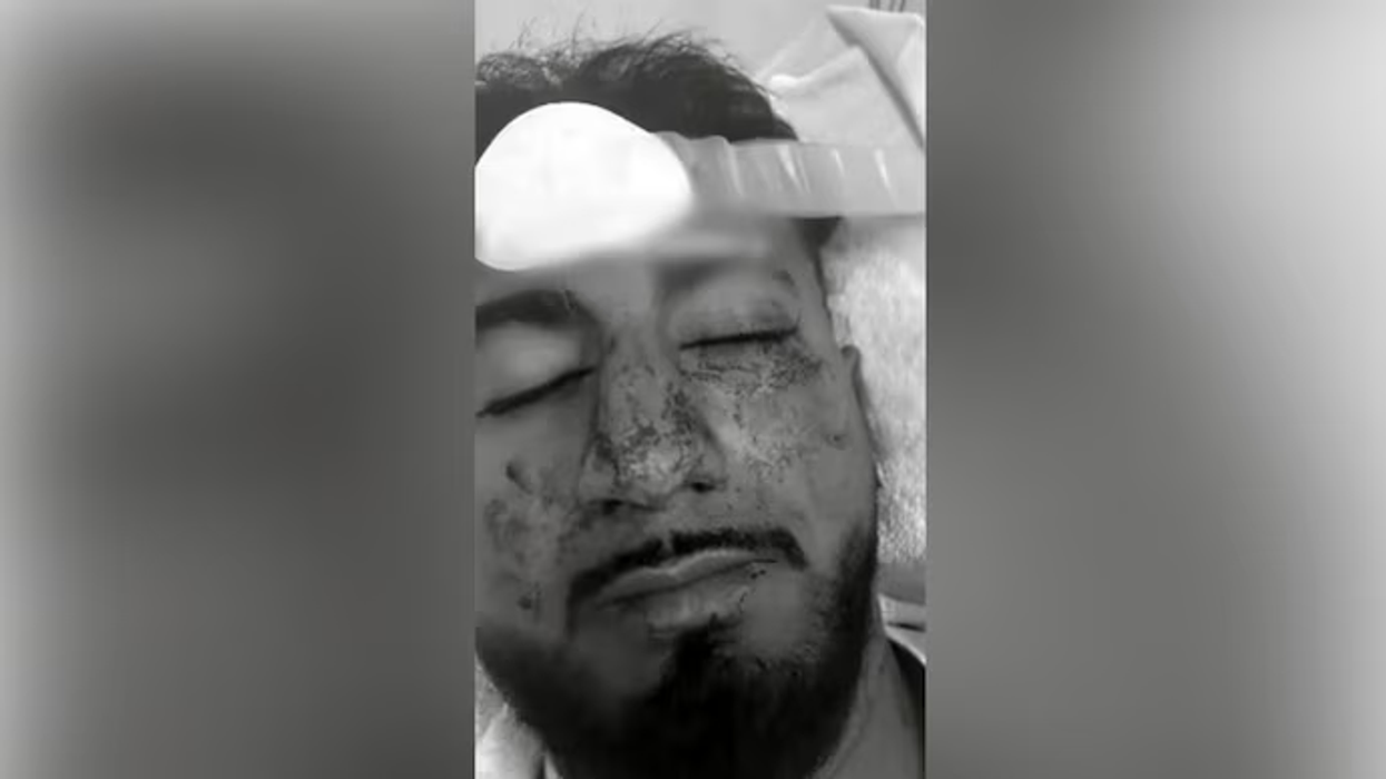Indian student brutally attacked in Australia after racial slurs over parking dispute