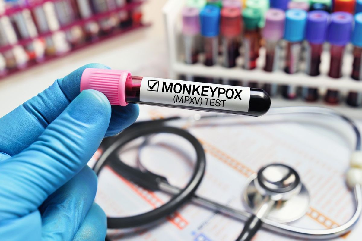 monkey-pox-pakistan