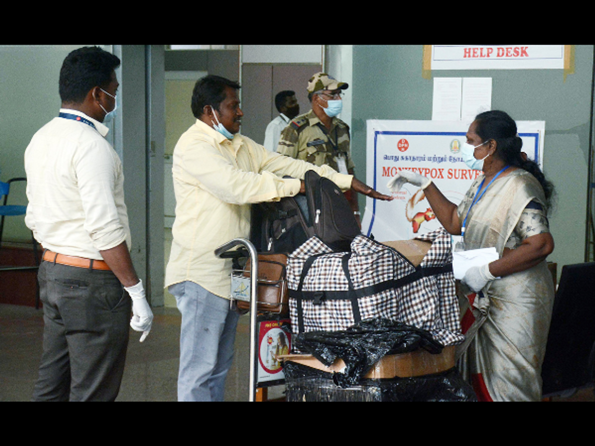 Monkeypox examination at Chennai airport