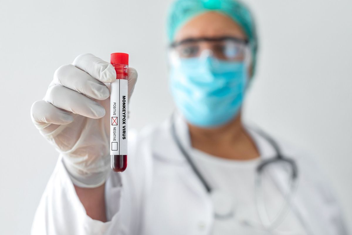 mpox-virus-testing