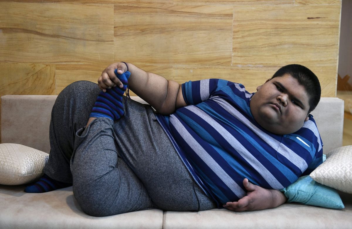BMI alone not sufficient in diagnosing obesity: researchers