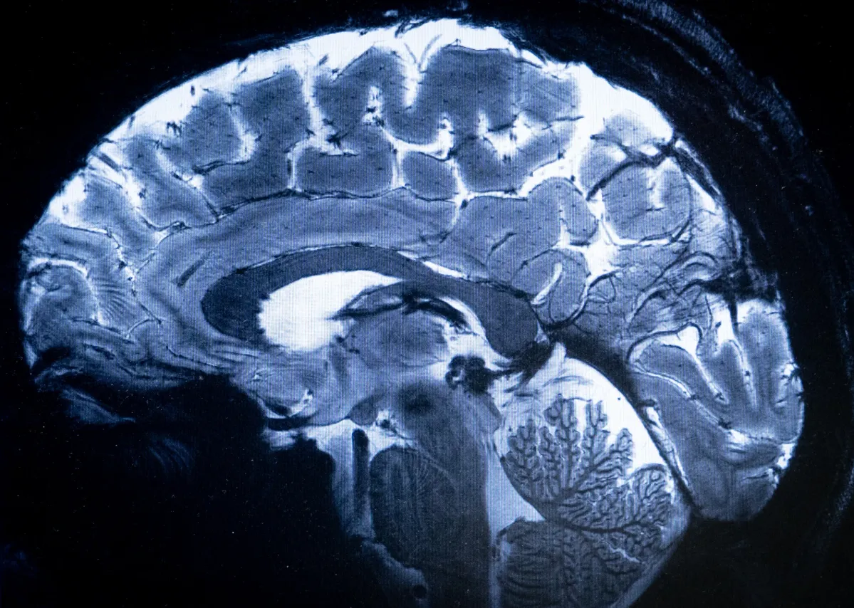 Climate change likely to impact people with brain conditions: study