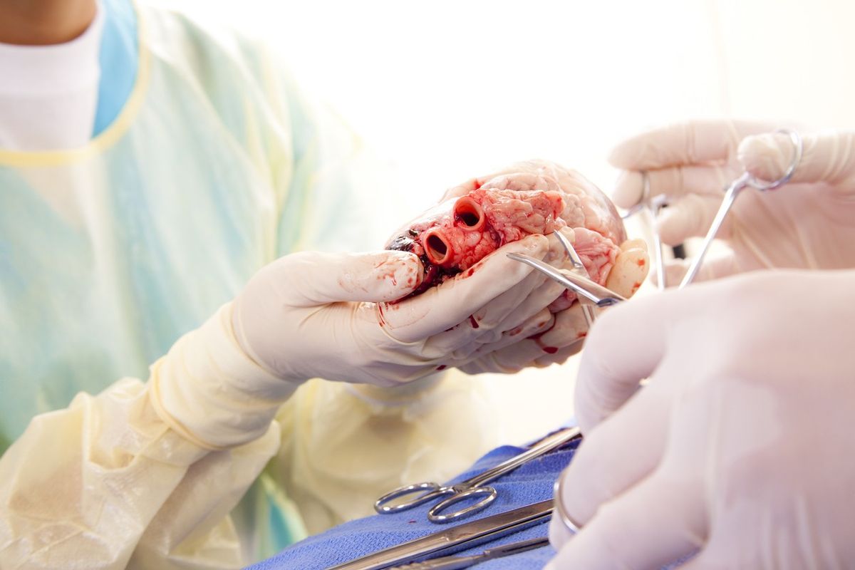 Pig heart transplanted in man