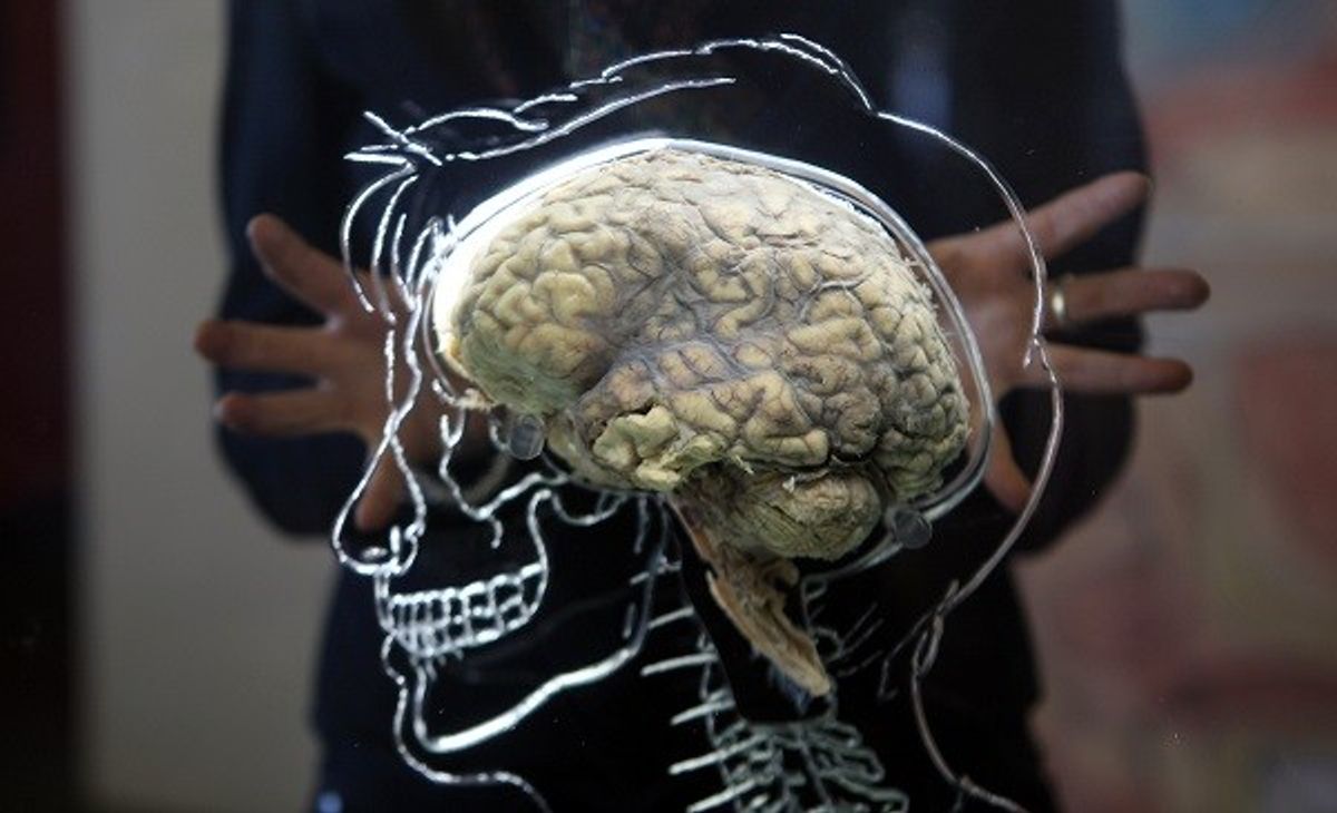 Electrical Brain Stimulation Can Boost Memory Function In Older People: Study