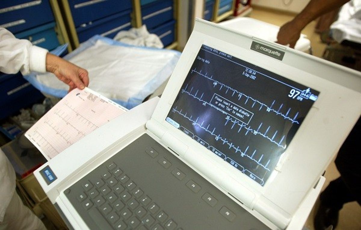 Indians Have Higher Average Resting Heart Rate: Indian Heart Study