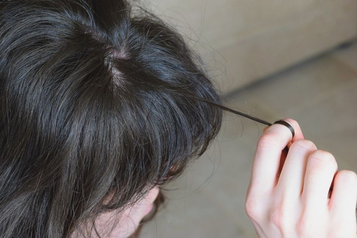 Young woman dreams of ‘full head of hair’ but in reality she has trichotillomania – Know all about this hair-pulling disorder