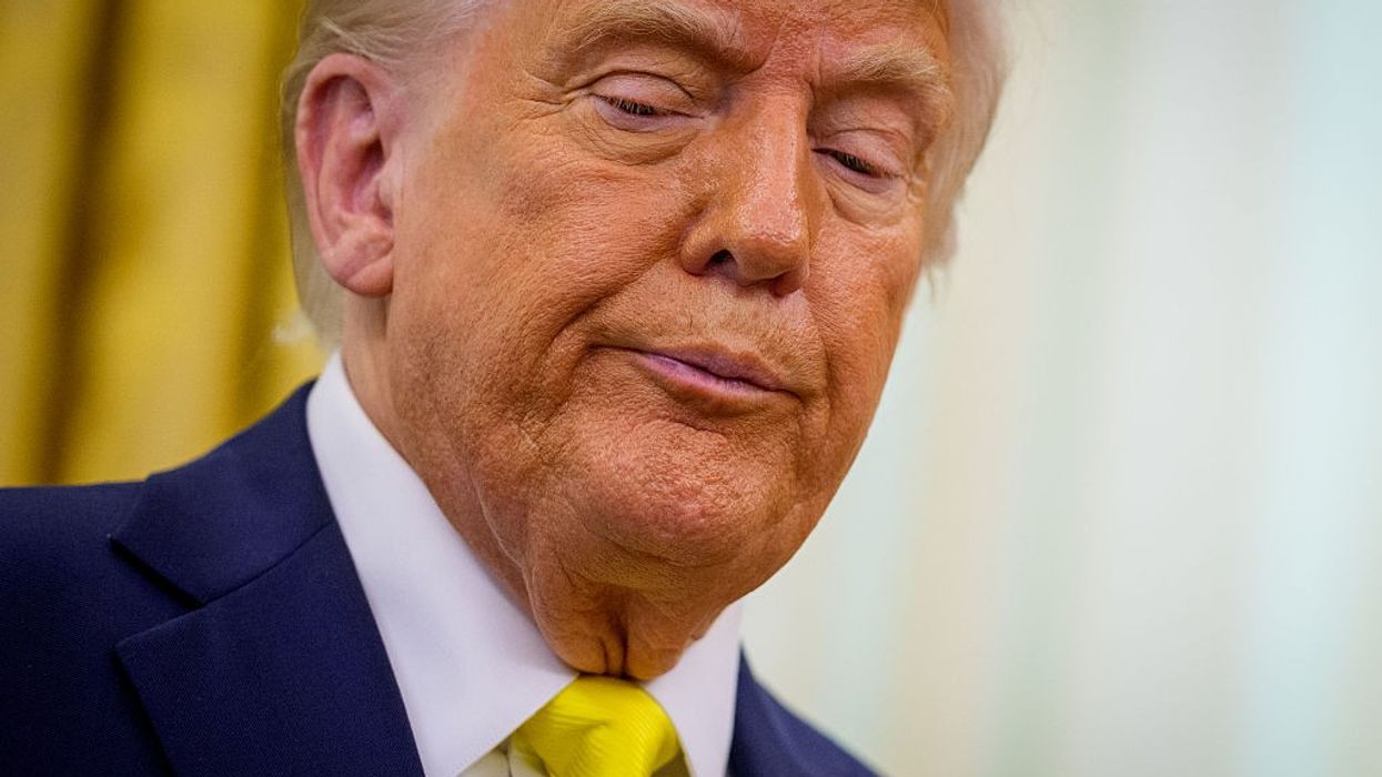 Trump Diagnosed with Chronic Venous Insufficiency—White House