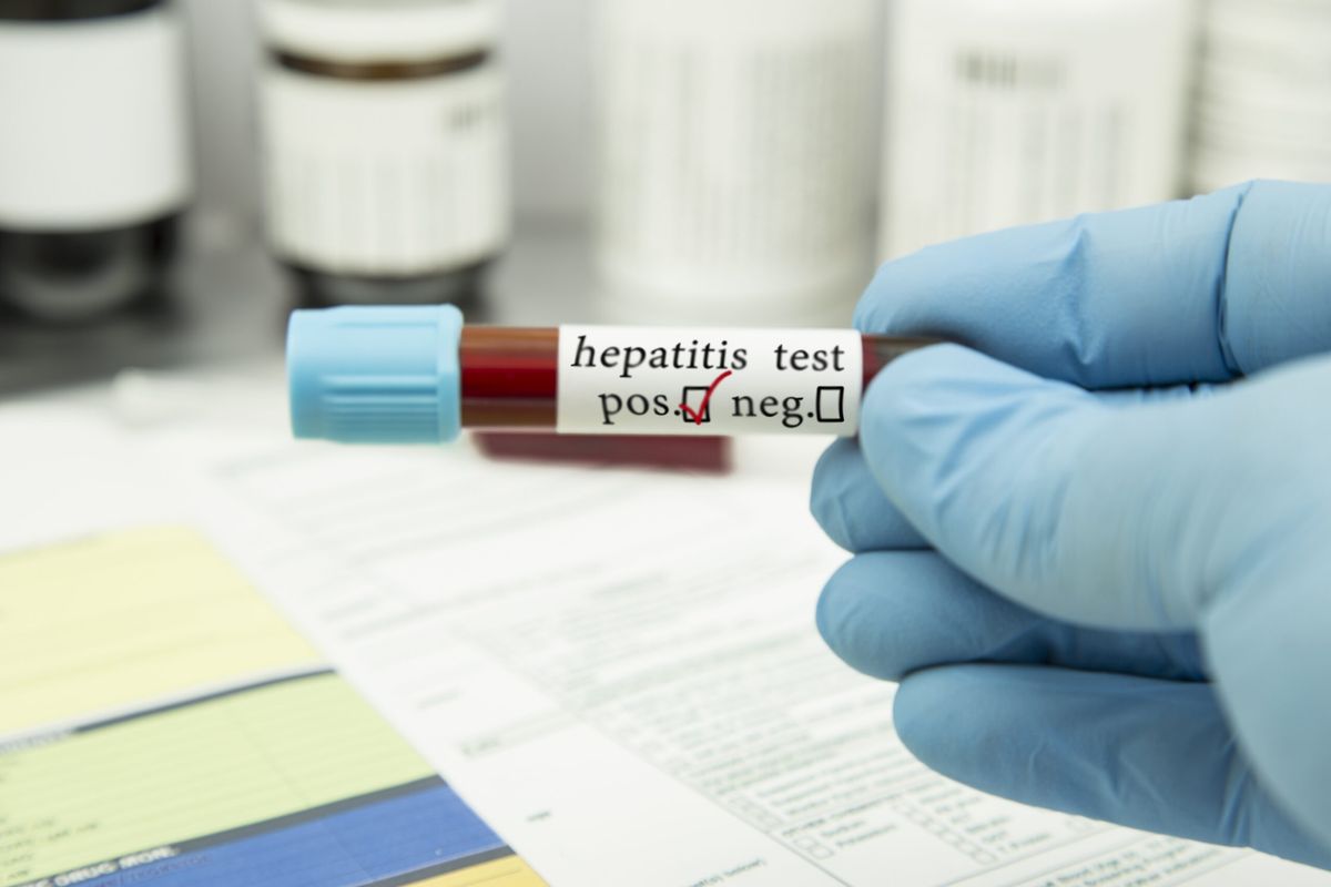 WHO raises alarm over 3,500 daily deaths from hepatitis infections